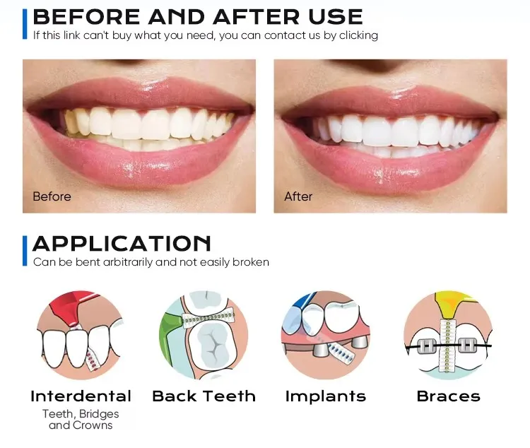 Professional Care Interdental Brush Dental Product Dental Equipment