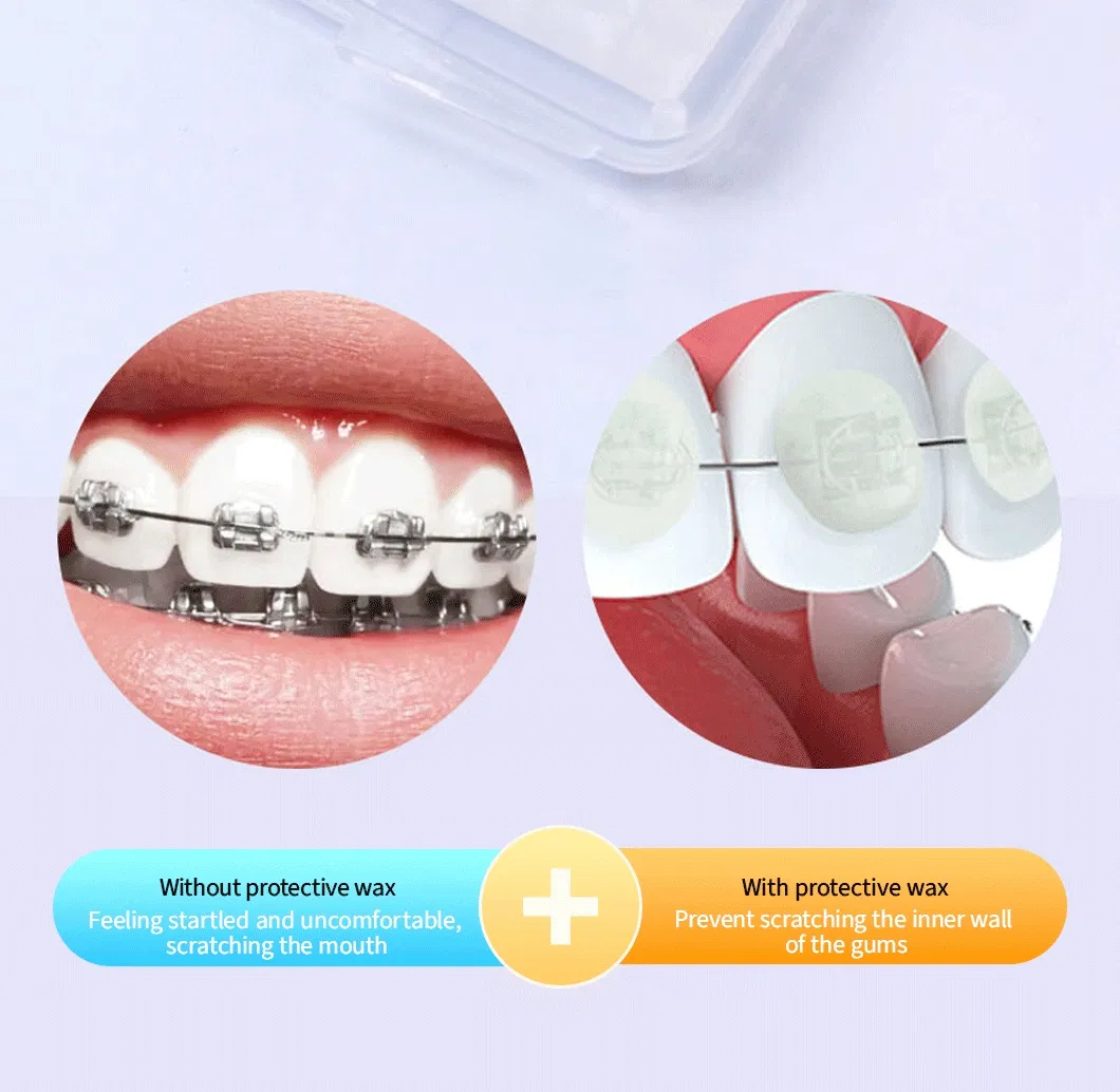 Gentle Interdental Brush Protection Wax Reduces Gum Bleeding and Improves Oral Hygiene