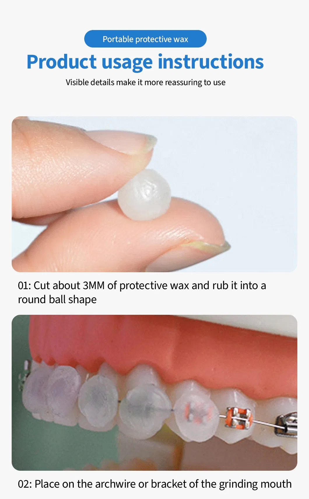Gentle Interdental Brush Protection Wax Reduces Gum Bleeding and Improves Oral Hygiene